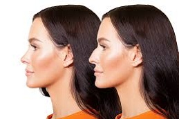 Best Non Surgical Nose Job in Abu Dhabi