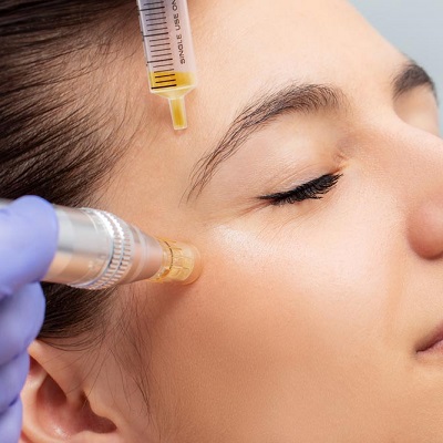 AquaGold Fine Touch Facial in Abu Dhabi khalifa City Cost & Price