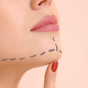 Double Chin Liposuction in Abu Dhabi & Al Ain Cost of Chin Lipo