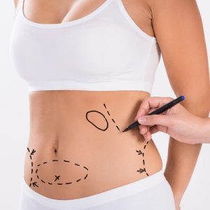 Liposuction Cost in Abu Dhabi & Al Ain-Remove Fat-Enfiled Royal