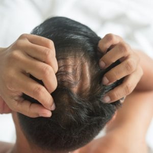Finasteride for Hair Loss in Abu Dhabi & Al Ain UAE