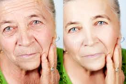 Fine Lines and Wrinkles Removal Clinic in Abu Dhabi & Al Ain