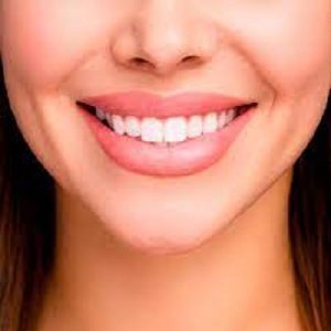 Best Hollywood Smile Makeover in Abu Dhabi & Al Ain Smile Makeover Cost