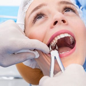 Best Tooth Removal in Abu Dhabi & Al Ain Tooth Removal Cost