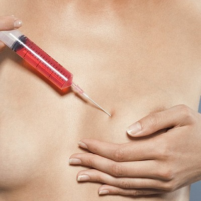 Breast Enlargement Injections Cost in Abu Dhabi
