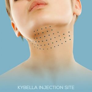 Kybella Treatment in Abu Dhabi khalifa City & Al Ain | Cost & Price