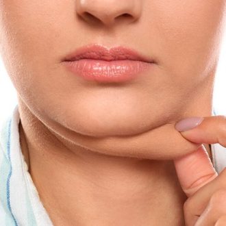 Double Chin Liposuction Recovery Time in Abu Dhabi
